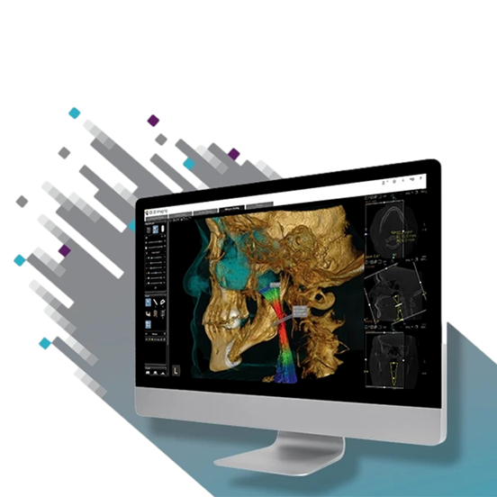 CS 3D Imaging: CS Airway 2 Licenses product image