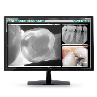 DEXclaim™ Full Software License product image