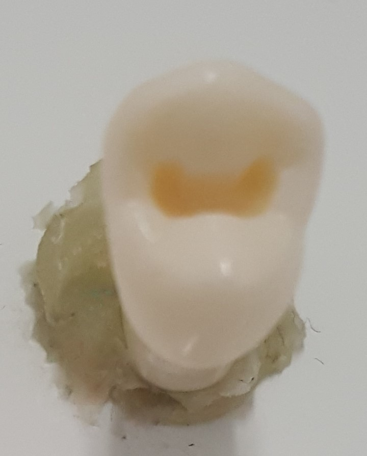 Crown Prep Teeth A21A-UR43 product image
