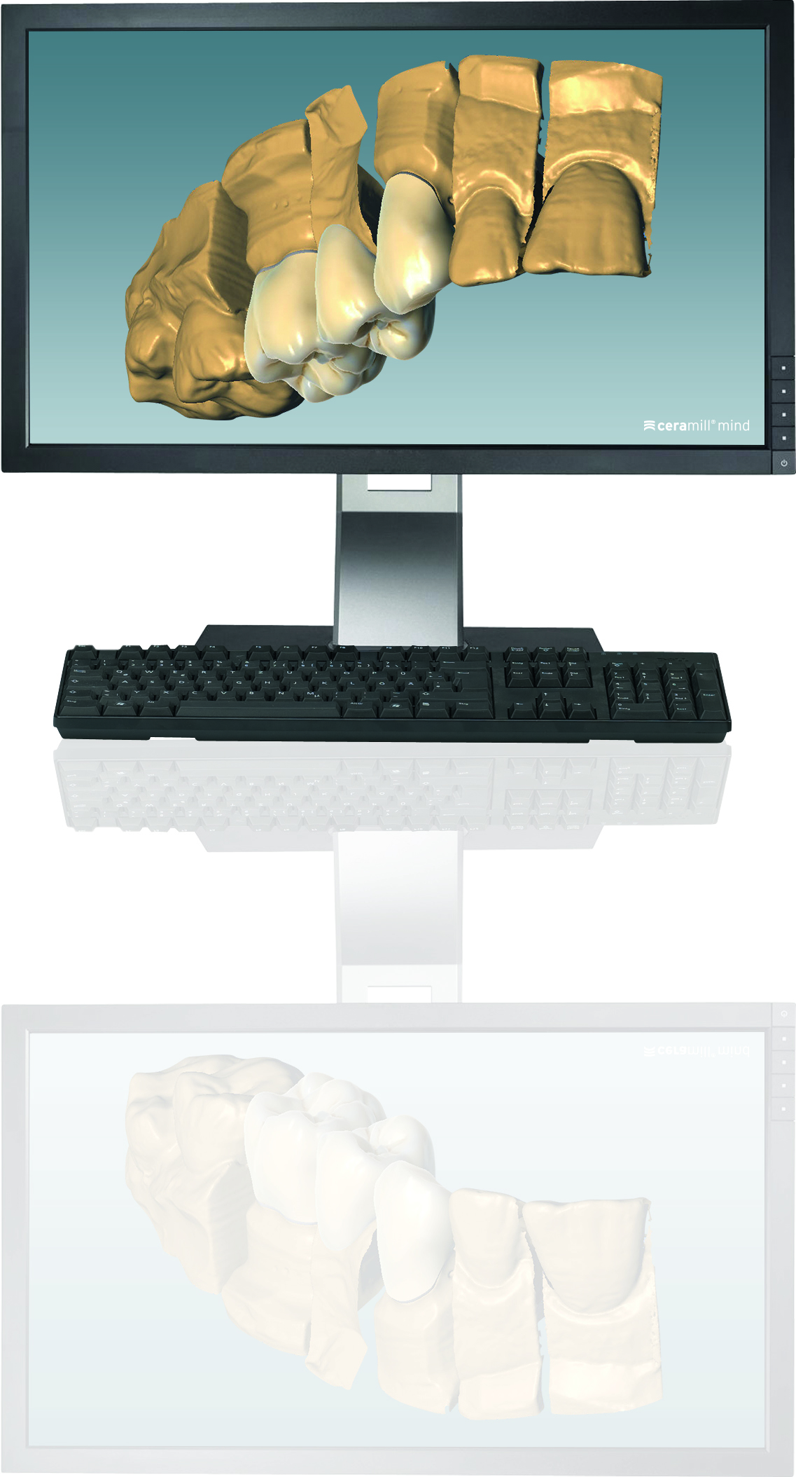 Ceramill Mind Trusmile Software product image