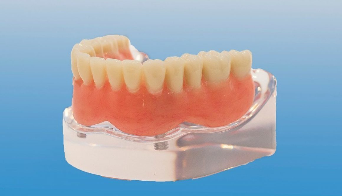 MLOC2 Overd Implant Locator product image