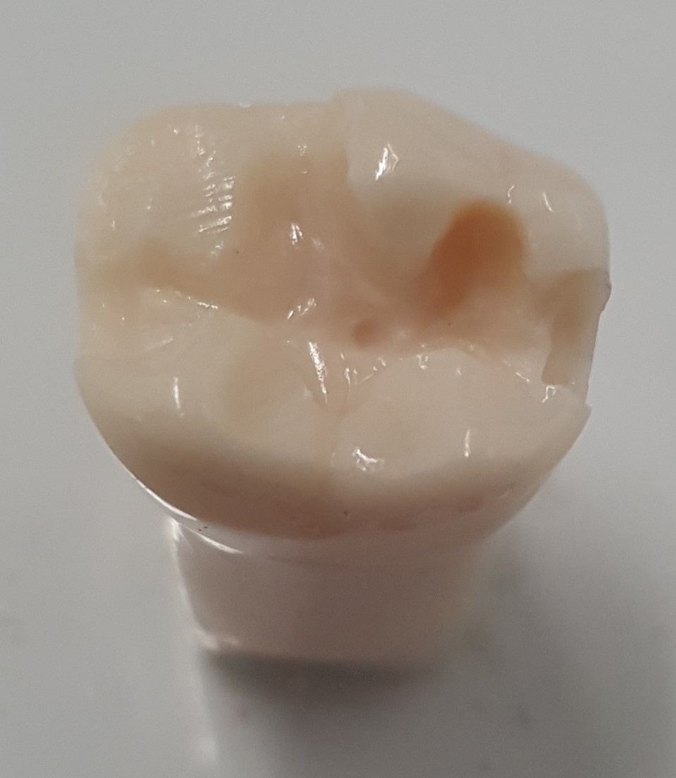Crown Prep Teeth A21A-LR69AJ product image