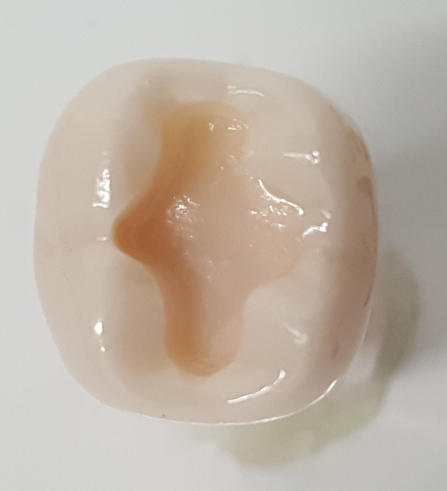 Crown Prep Teeth A21A-LL73A product image