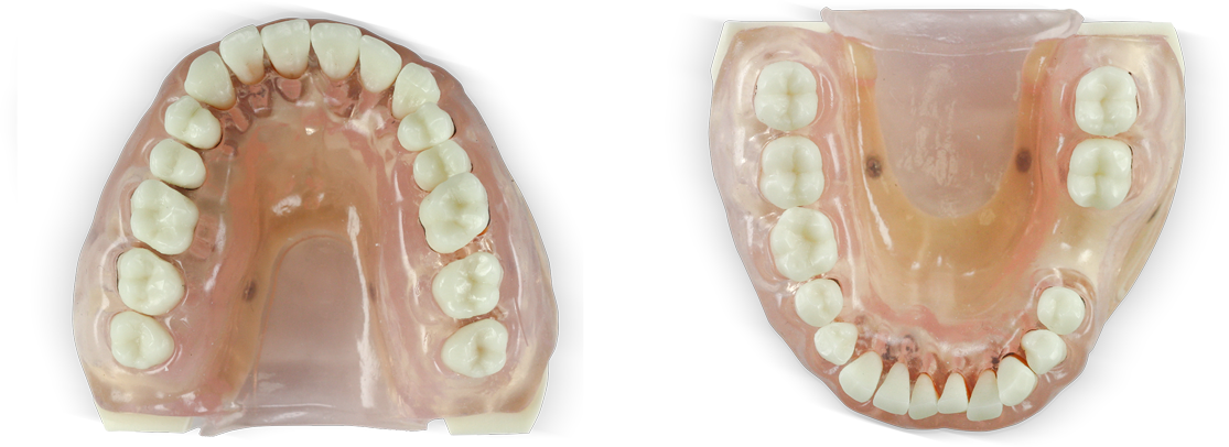 ModuPRO Clear Perio Refill Kit product image