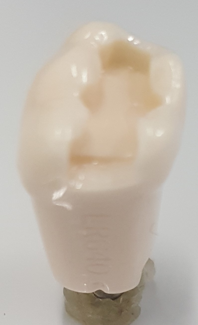 MO Prep Tooth #30 product image