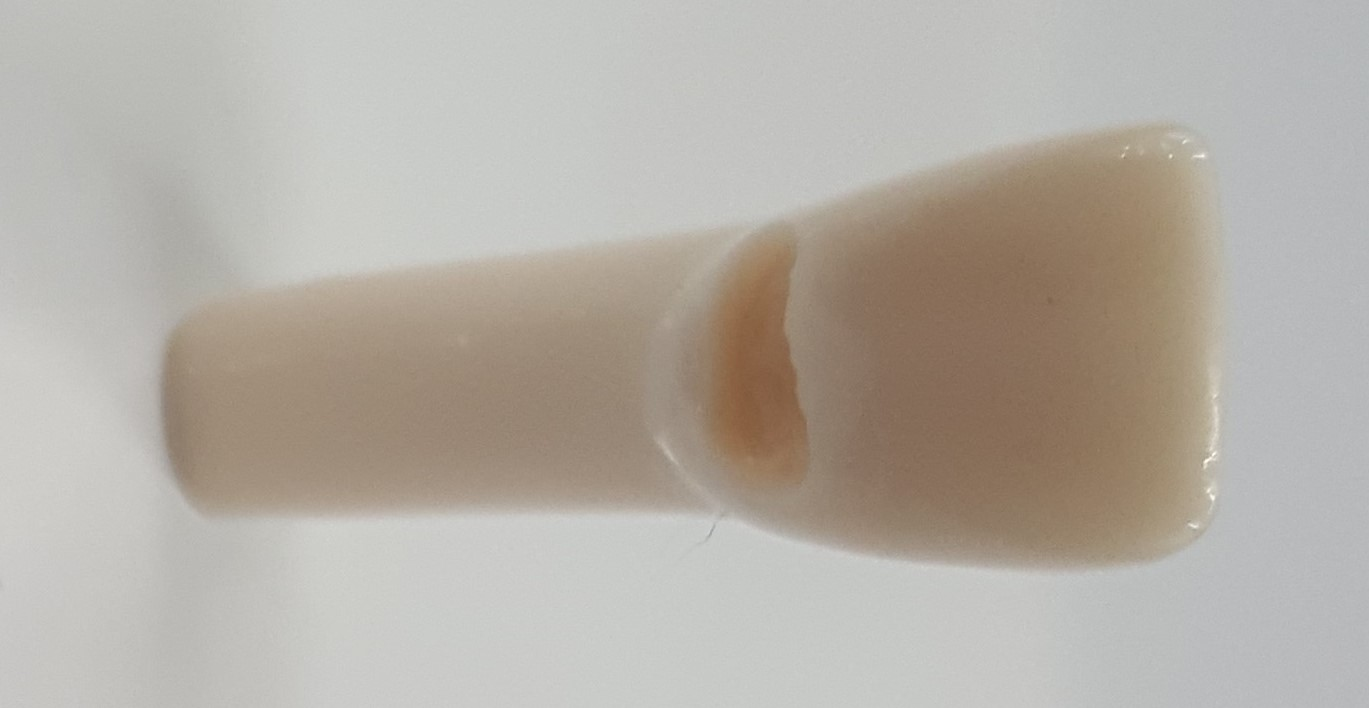 Crown Prep Teeth #8 Class V product image