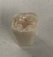 Crown Prep Teeth A21A-LL76 product image