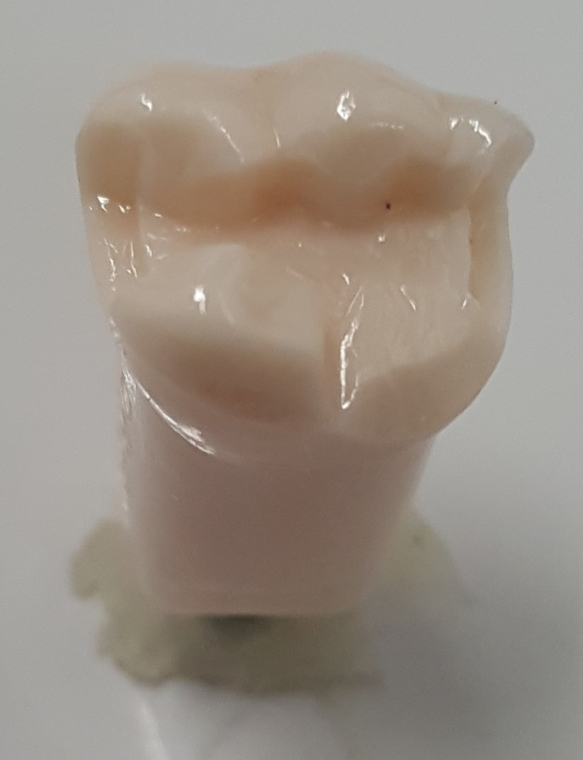 Crown Prep Teeth A21A-LR66 product image
