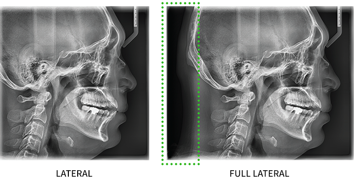 GreenX 18 x 15 product image