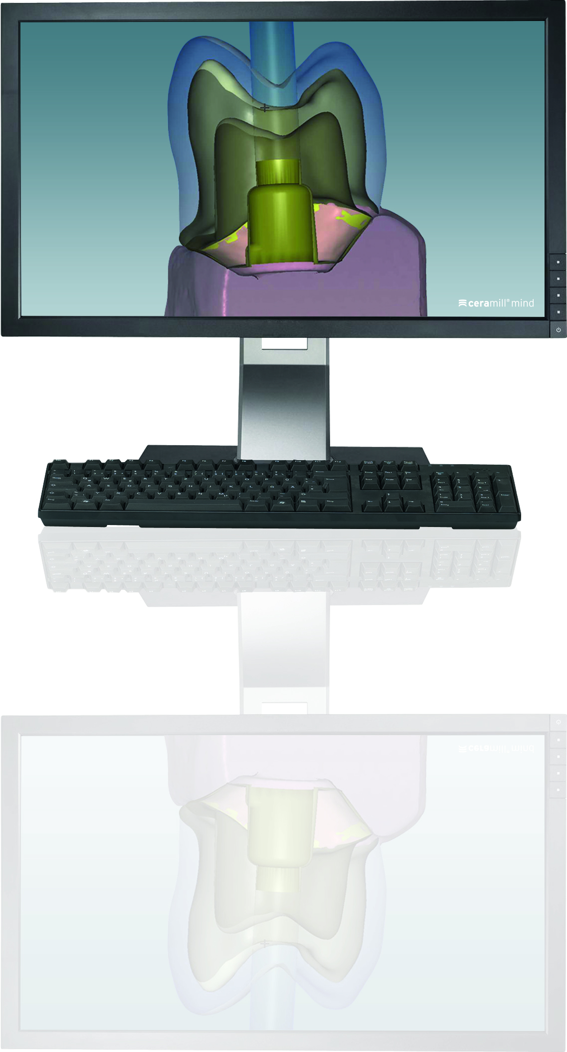 Ceramill M-Plant Software product image