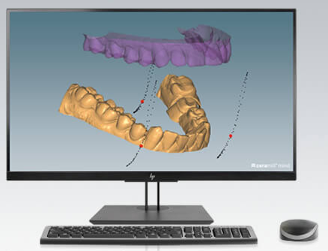 Ceramill M-Pass product image
