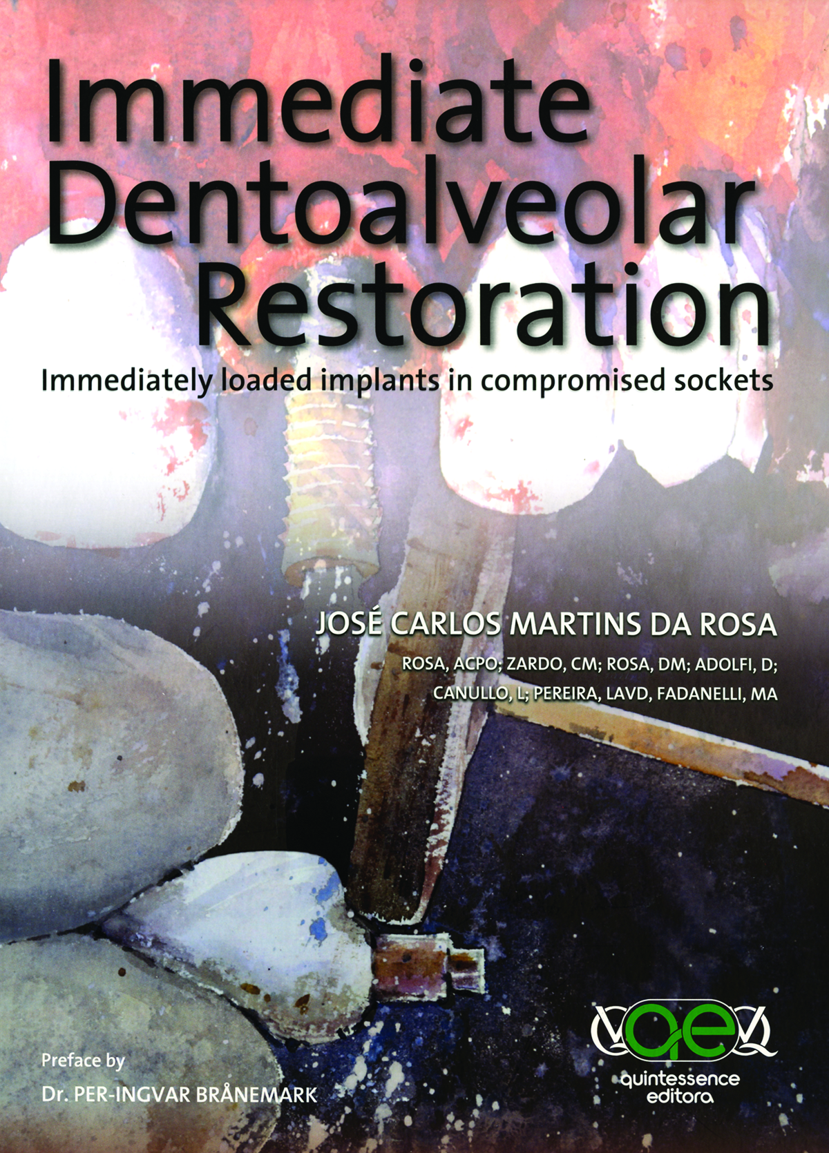 49766CEE6D4A64A1548E4314821096E3