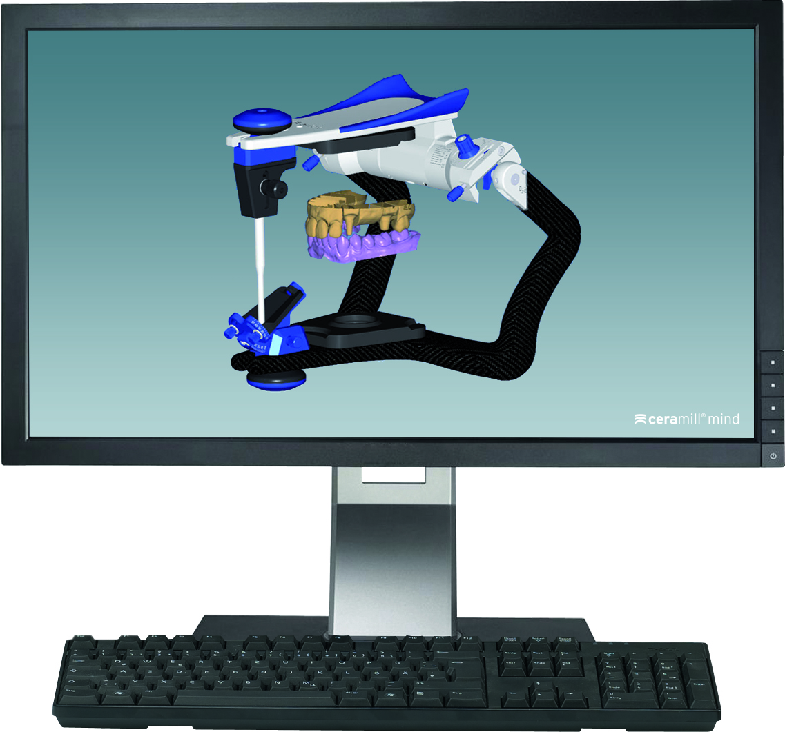 Ceramill Mind product image