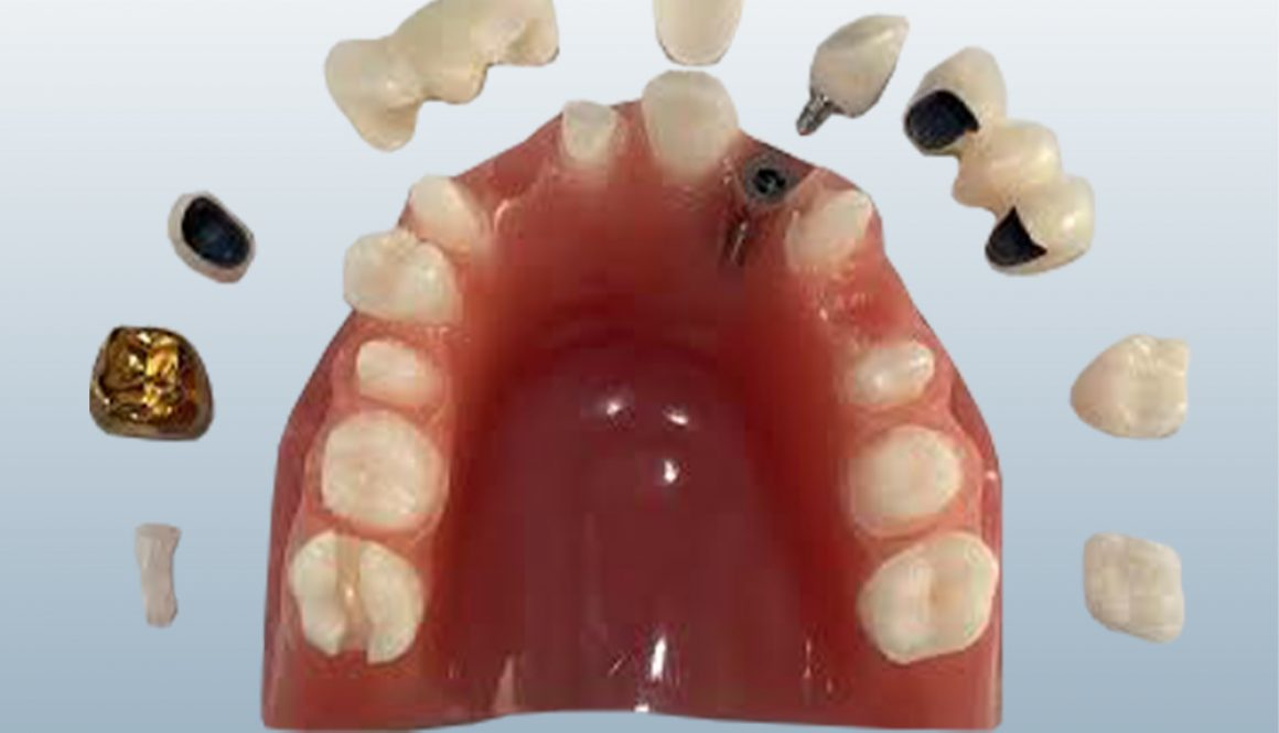 #9 Veneer for MKI-349 Model product image