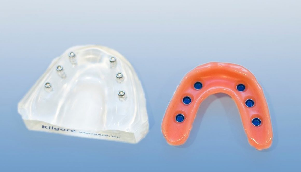MLOC6 OverD Implant Locator product image