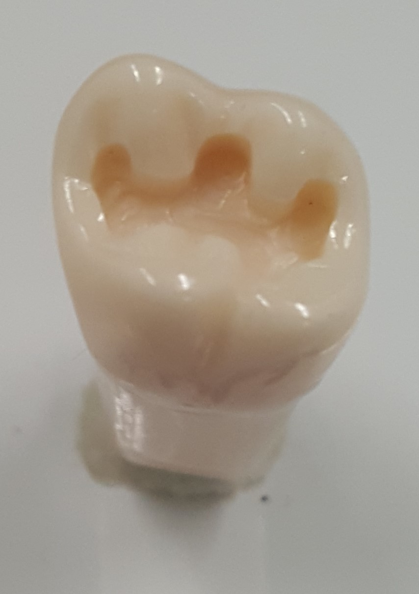 Prep Tooth #14 O UL63A product image