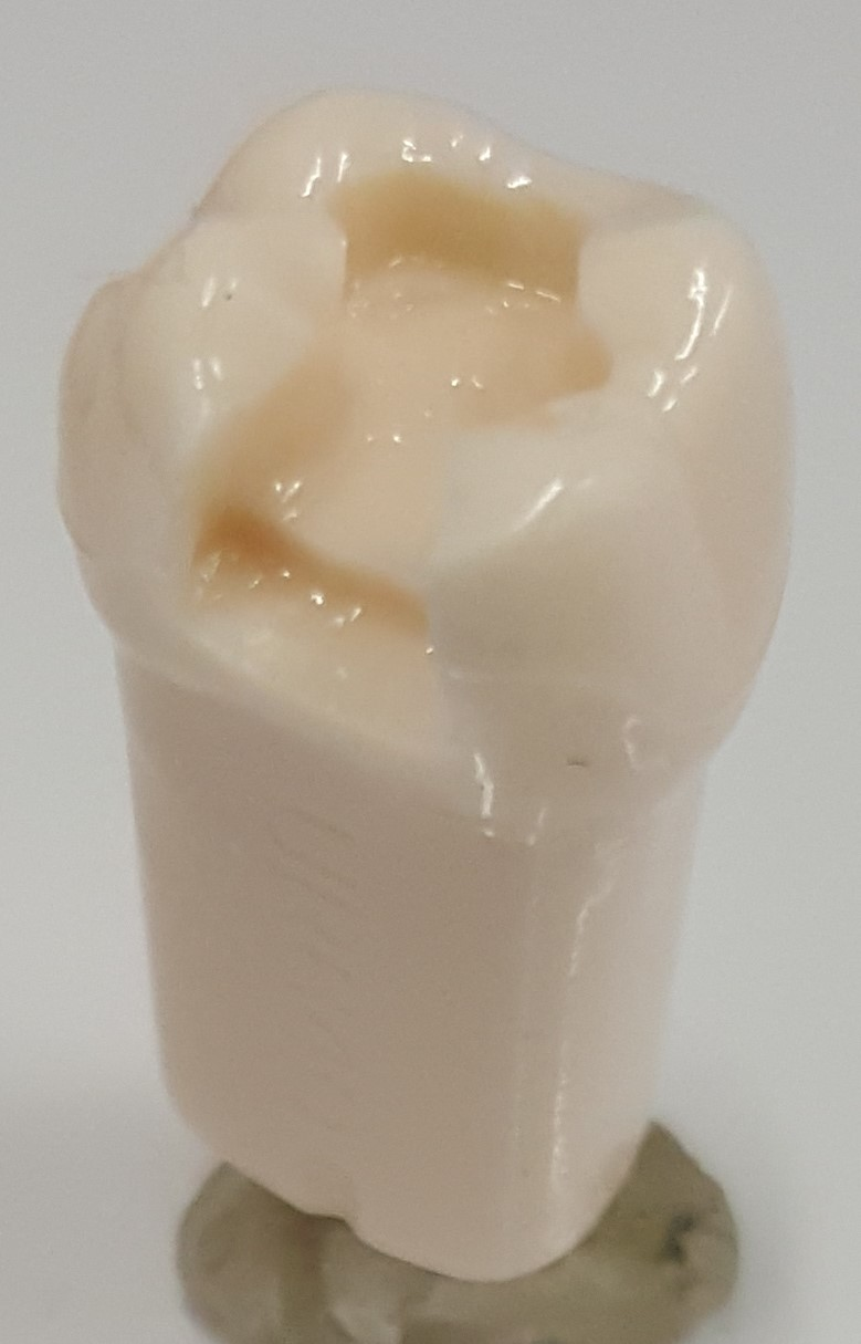 MO New Prep Tooth #3 product image