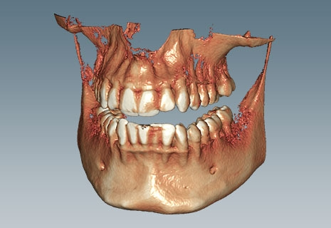 Ceramill® Dicom Viewer product image