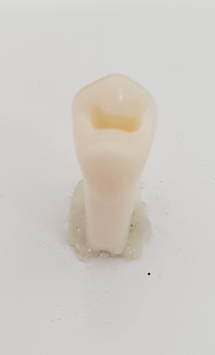 Crown Prep Teeth A21A-UL53 product image