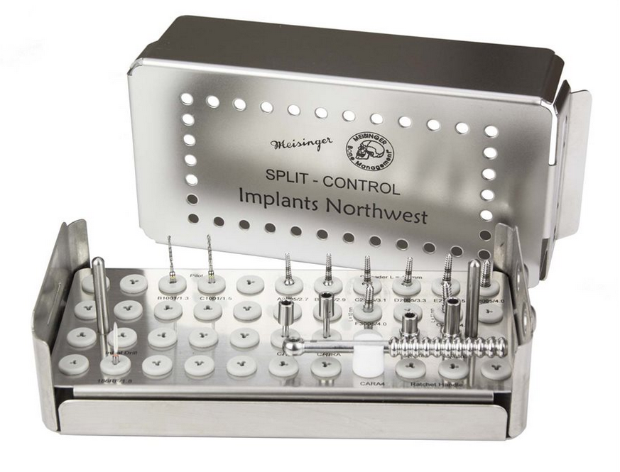 Implant NW Split Control Kit thumbnail 2