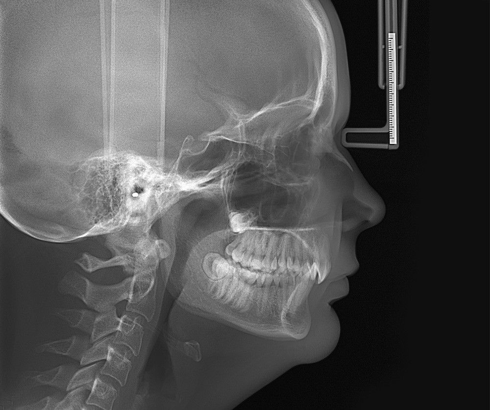 OP 3D Pro Cephalometric Up Left with Sens product image