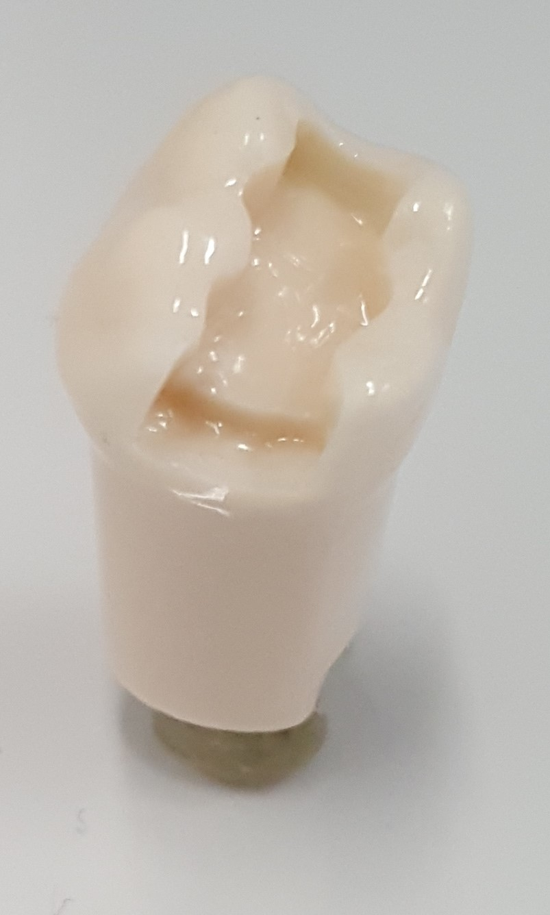 Tooth #19 D.O Prep product image