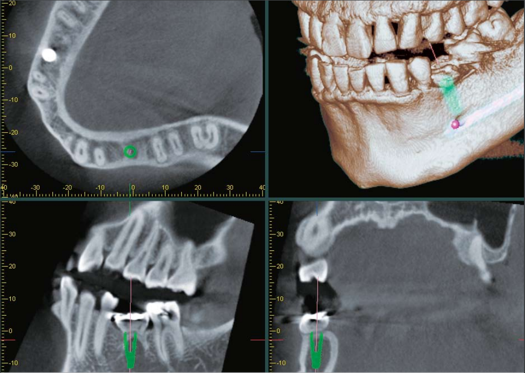 i-Dixel Client Software License with USB Key product image