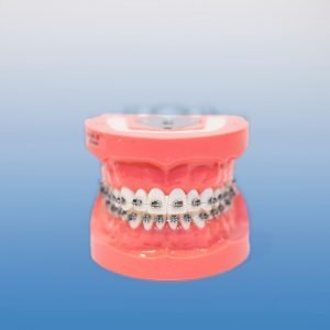Hard Tissue Ortho Typodont - Hard Tissue Ortho Typodont - Image 1
