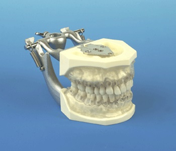 Hygiene Model with Transparent Gums thumbnail 2
