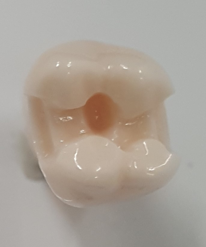 Prep Tooth #14 M.O.D UL66H product image