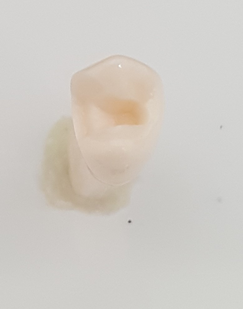 Crown Prep Teeth A21A-UL54J product image