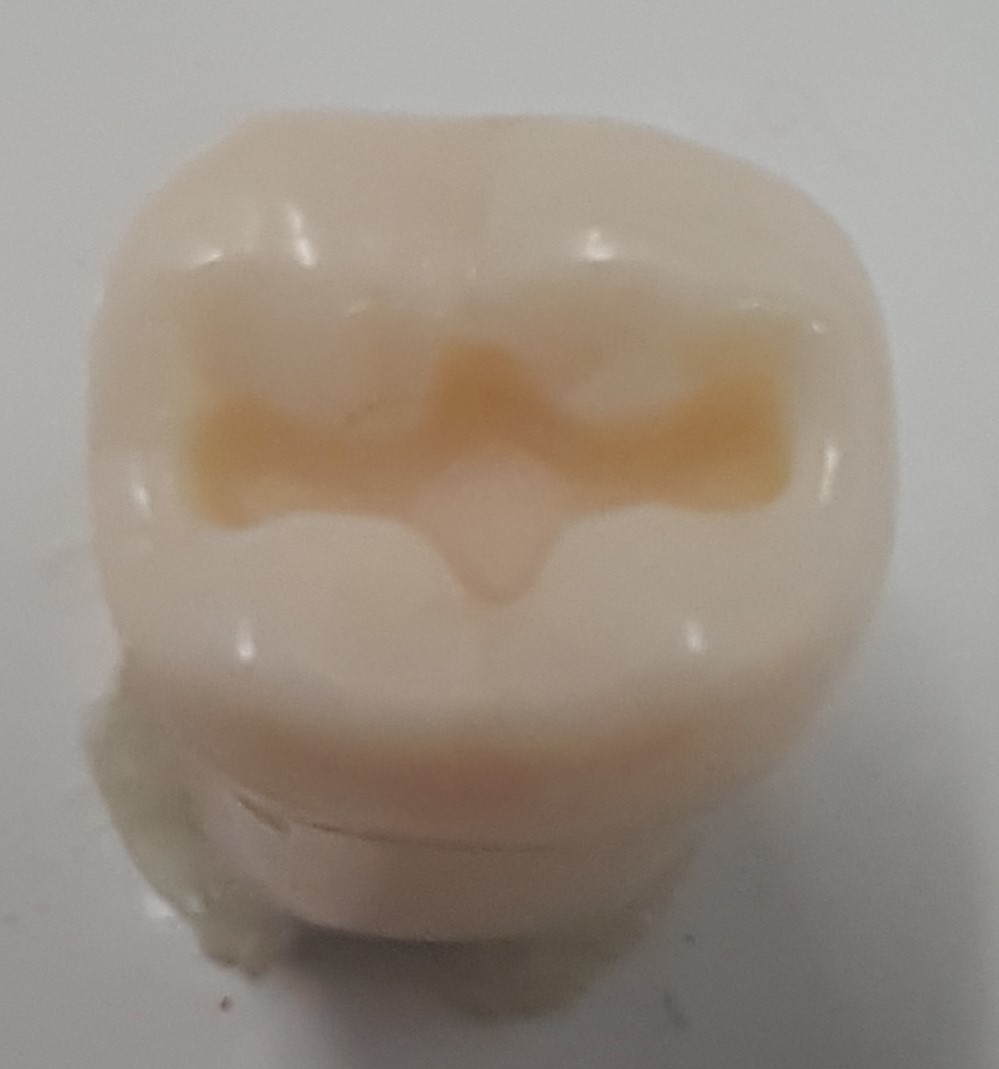 Crown Prep Teeth A21A-LR73 product image