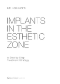 ITI Treatment Guide, Vol 1: Implant Therapy in the Esthetic Zone 