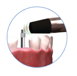 Smartpeg Type 7 Mount Pack of 5 image