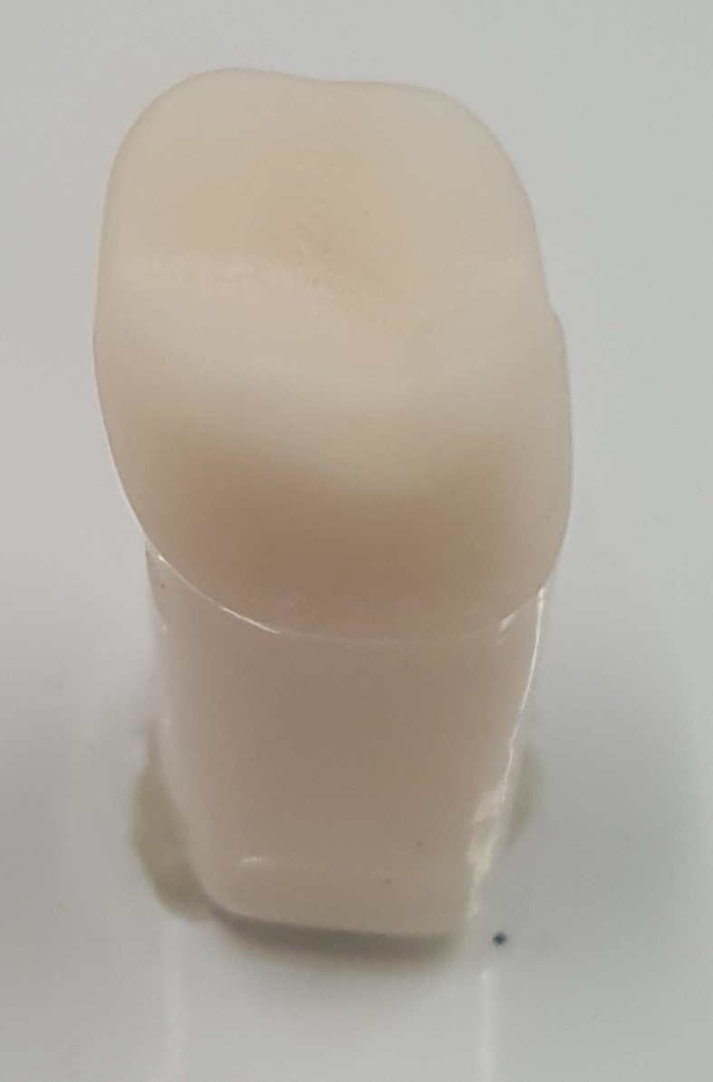 A21AN-UL62 F/C Crown Prep Tooth #14 product image