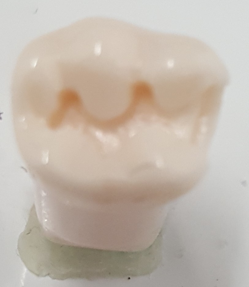MO Prep Tooth #19 product image