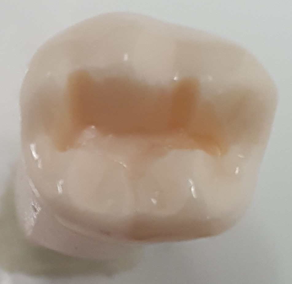 Prep Tooth #19 O LL63 product image