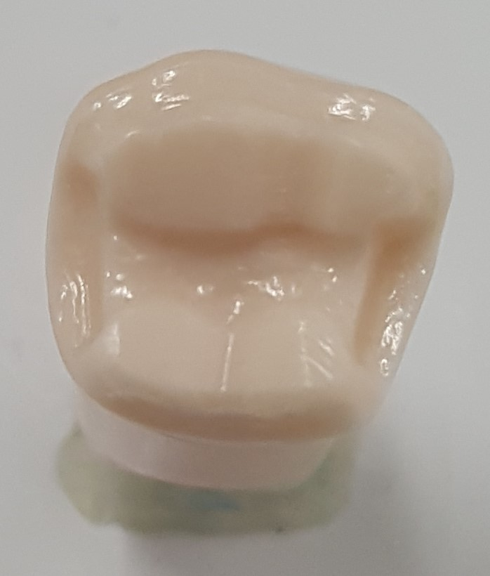 Prep Onlay #19 A21AN-UL62A image