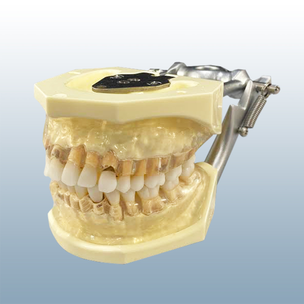 Periodontal/Hygiene Model Clear product image