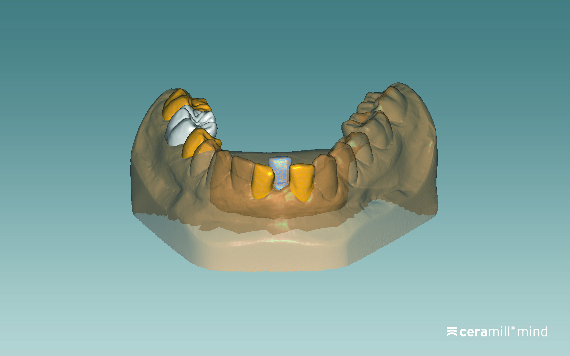Ceramill Microshell Software product image