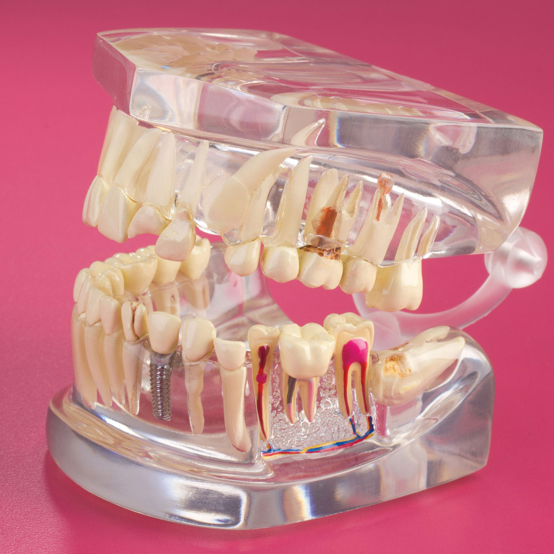 Clear Human Jaw Model product image