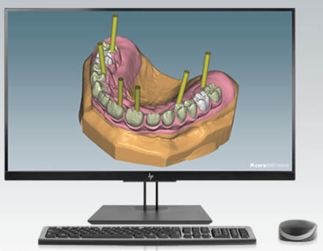 Ceramill® M-gin product image