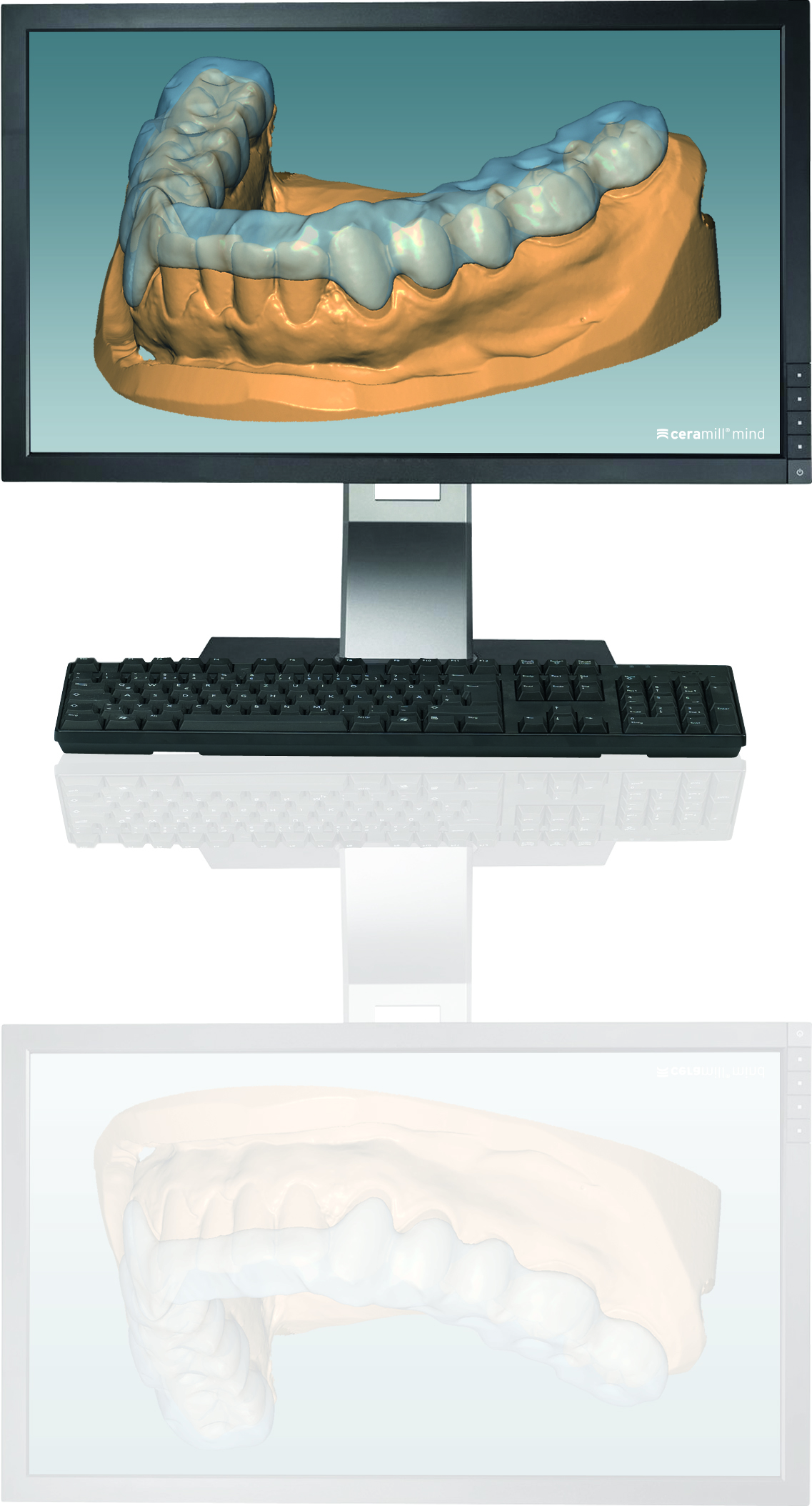 Ceramill M-Splint Software product image