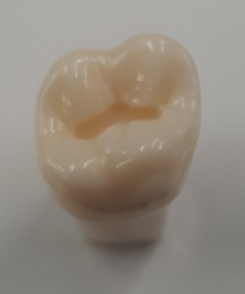 Prep Tooth #3 O UR63L product image